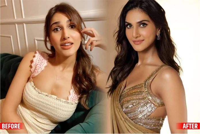 Vaani Kappoor The Btown Actresses Before and After Plastic Surgery