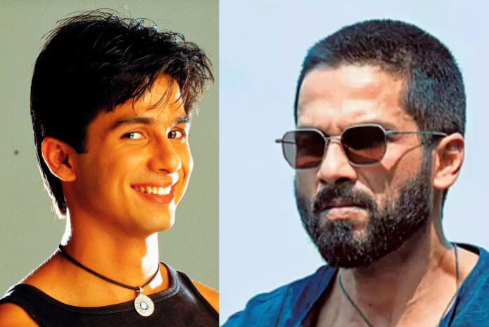 Shahid Kapoor before and after plastic surgery
