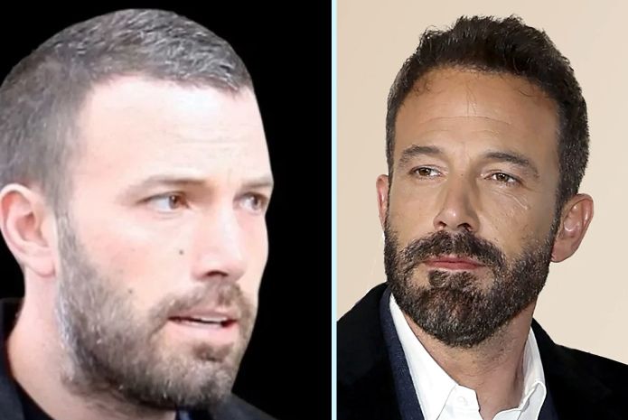 Ben Affleck